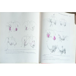 Aesthetic plastic surgery / volume II / illustrations by Daisy...