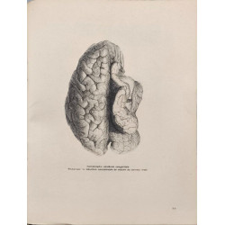 L'esprit et ses maladies (60 planches en héliogravures)