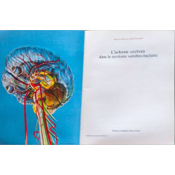 L'ischémie cérébrale dans le territoire vertébro-basilaire