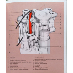 L'ischémie cérébrale dans le territoire vertébro-basilaire