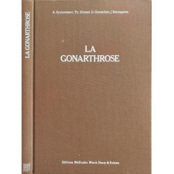 La gonarthrose