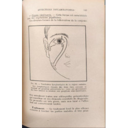 Manuel élémentaire d'ophtalmologie