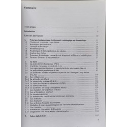 Atlas radiologique des maladies rhumatismales 1ère partie - la main