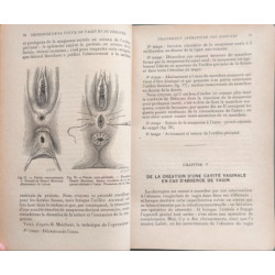 Chirurgie de l'appareil génital de la femme