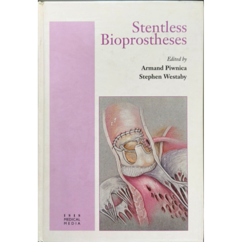 Stentless Bioprostheses